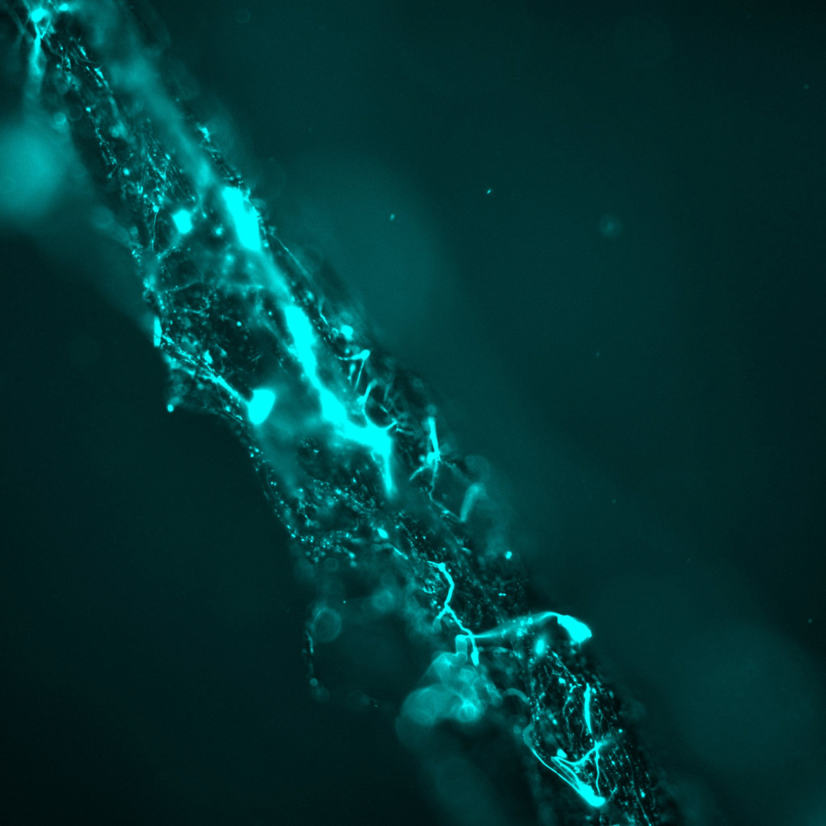 Fluorescent micrograph of a fungal rhizomorph; bright cyan patches indicate local membrane depolarisation zones.