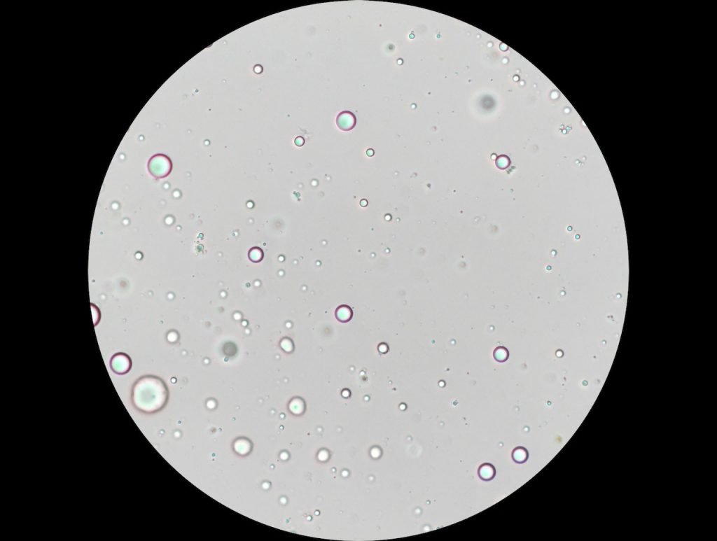 Microscopic image of oleosomes, resembling a cratered moon, symbolizing the parallels between medicine and space exploration.